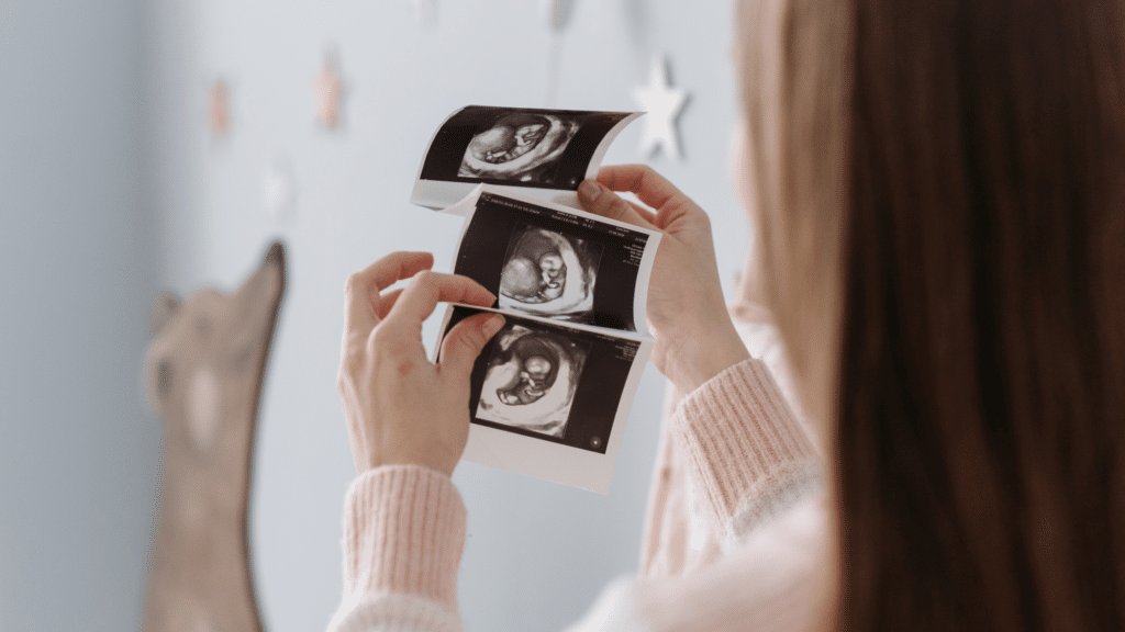 10 Essential Things to Do Before Your Baby Arrives